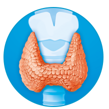 Enlarged thyroid gland (goitre) due to iodine-deficiency